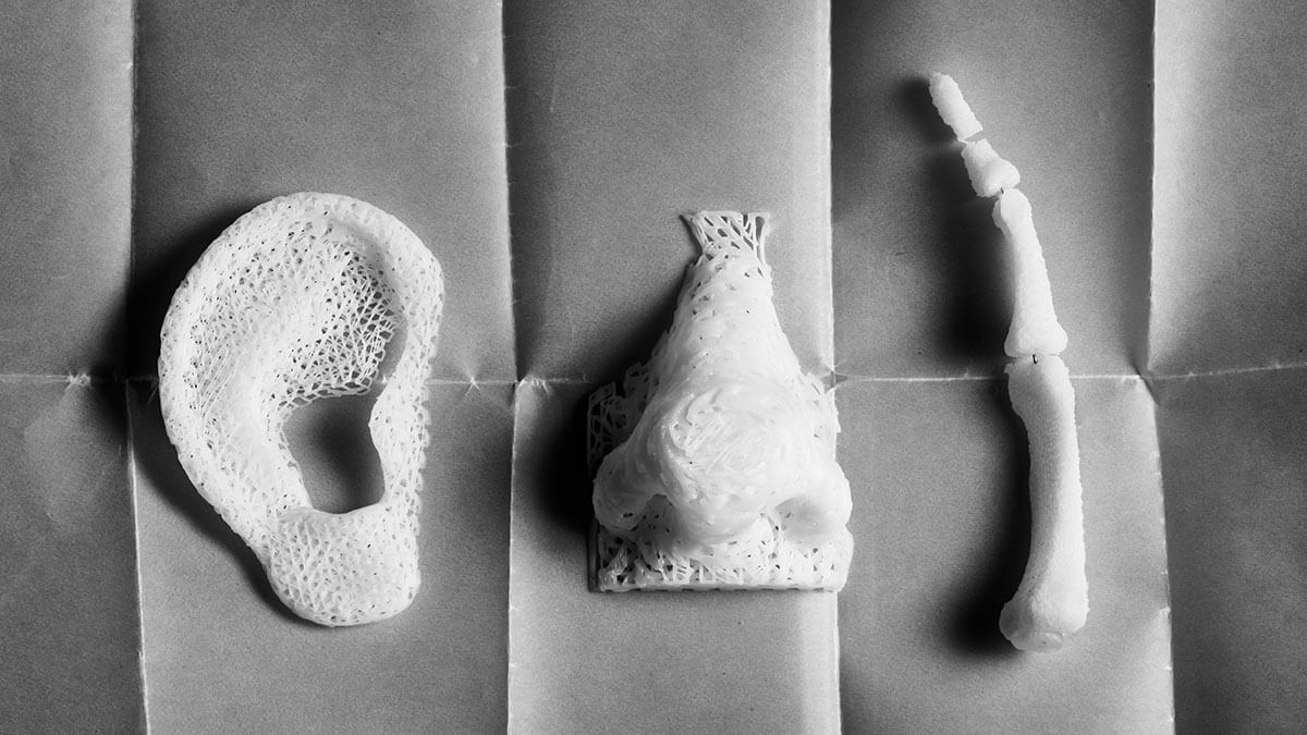 3D printing in healthcare