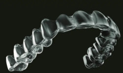 Applications of 3D printing in dentistry