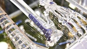 What Are the Uses of Anodized Titanium